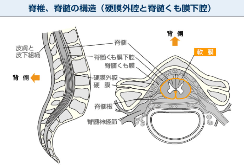 硬膜外　脊髄